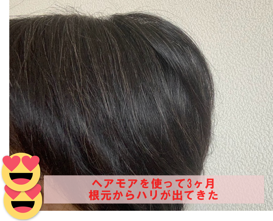 ヘアモアを使って3ヶ月