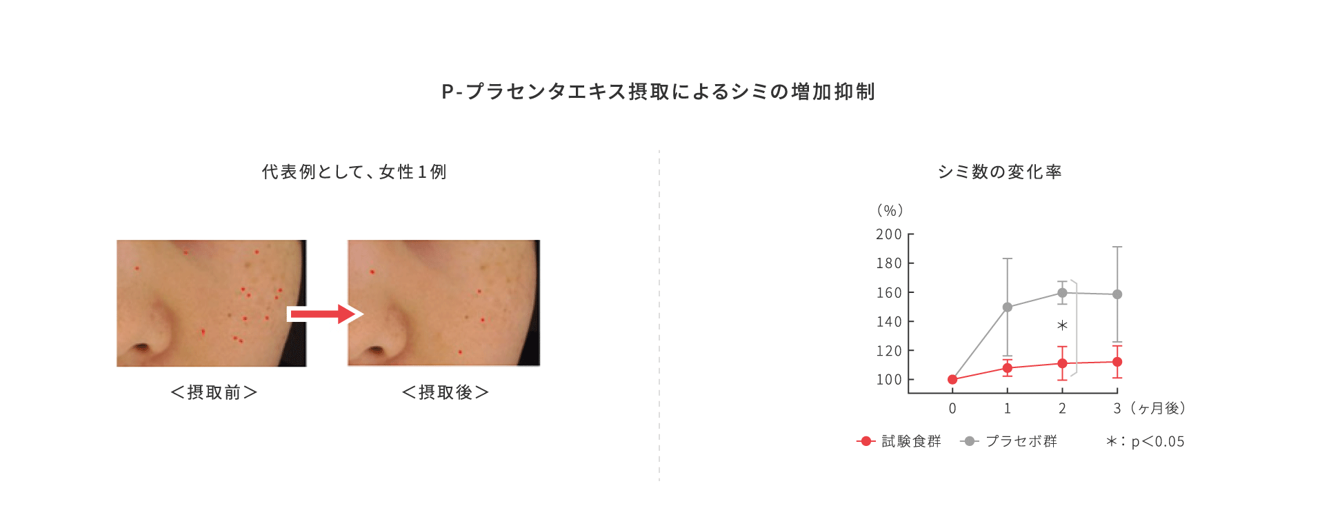 プラセンタエキス