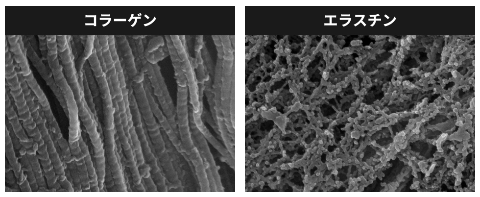 エラスチン