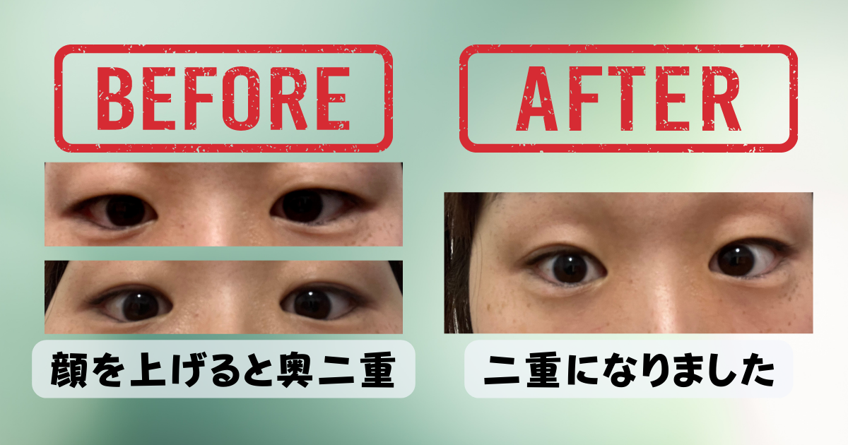 ナイトアイボーテ NEWナイトアイボーテ3セット NEWナイトアイボーテ（アイメークアップ