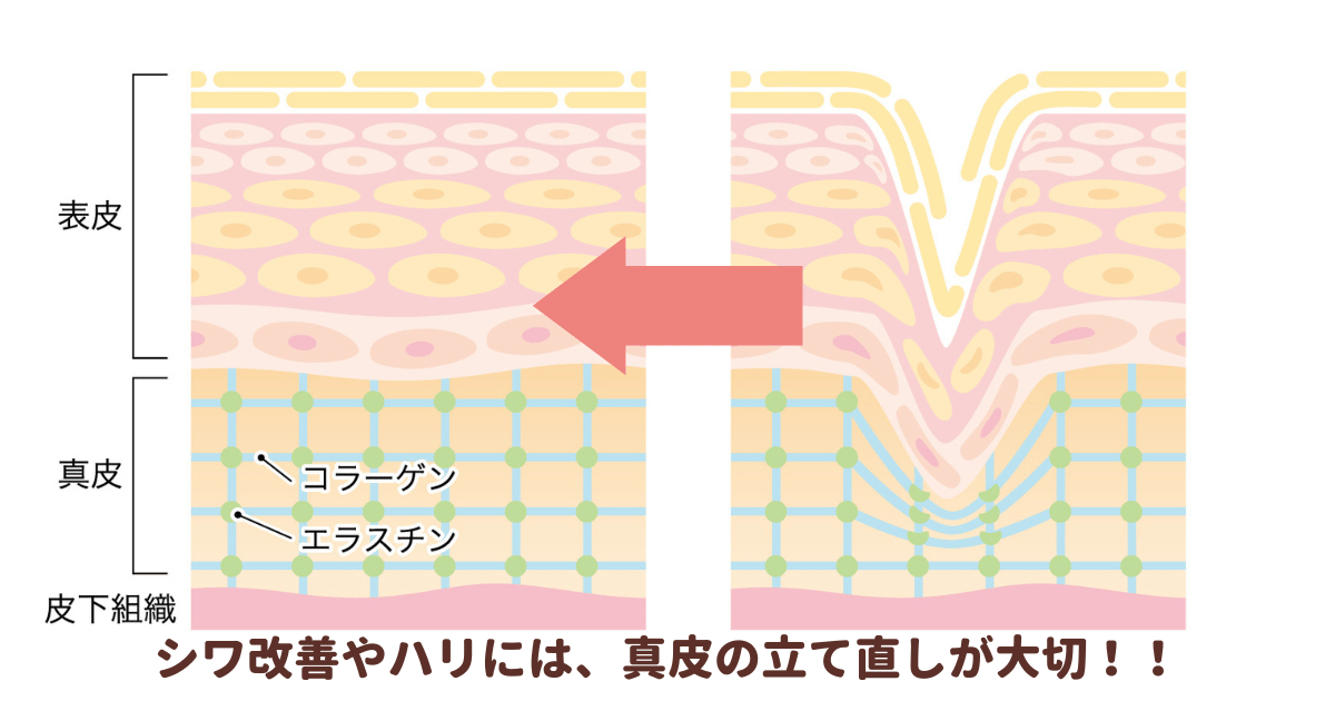 肌断面図