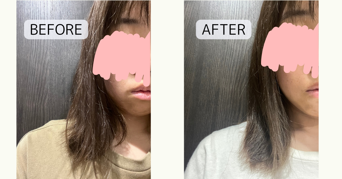 before-after