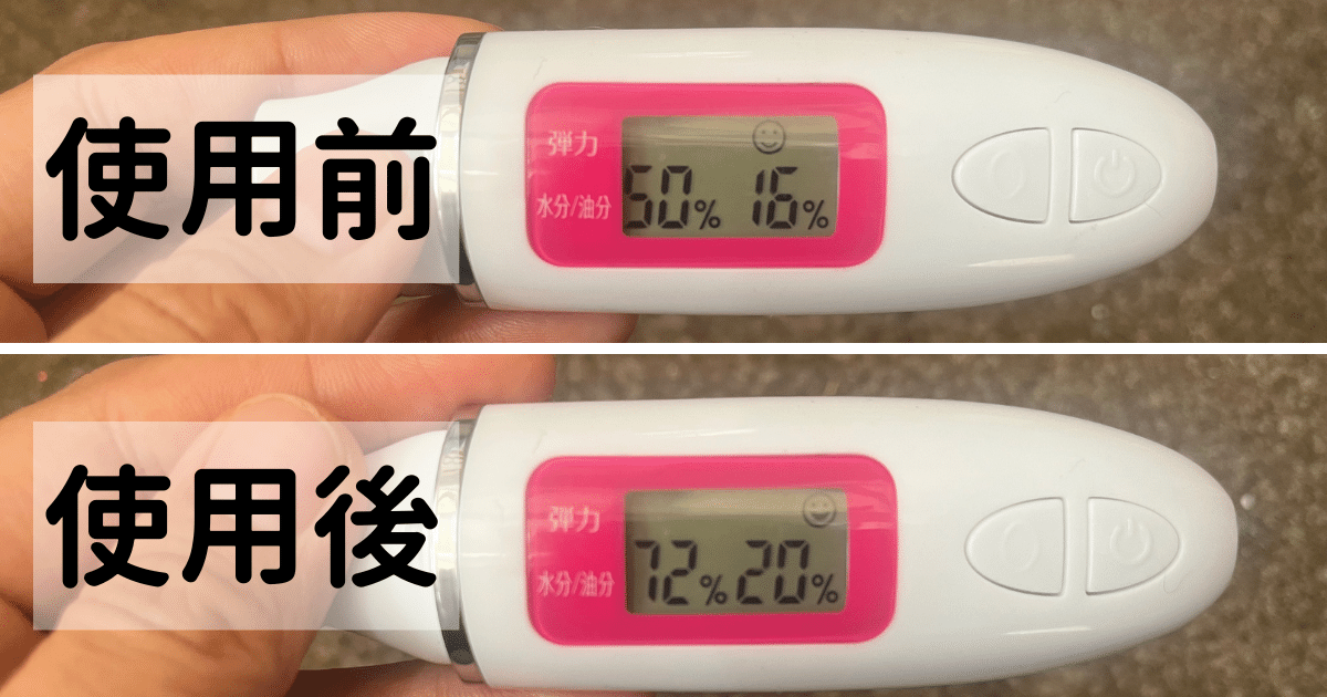 ドクターシーラボ VC100エッセンスローションEX使用前後