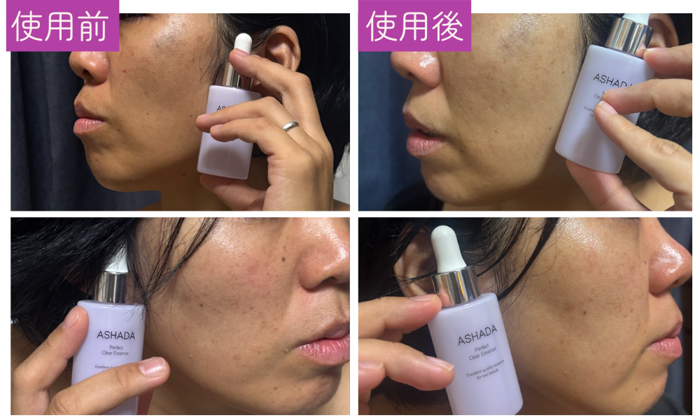 ASHADA(アスハダ)パーフェクトクリアエッセンス使用感比較