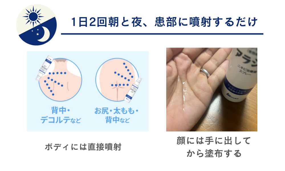 アラジルの使い方
