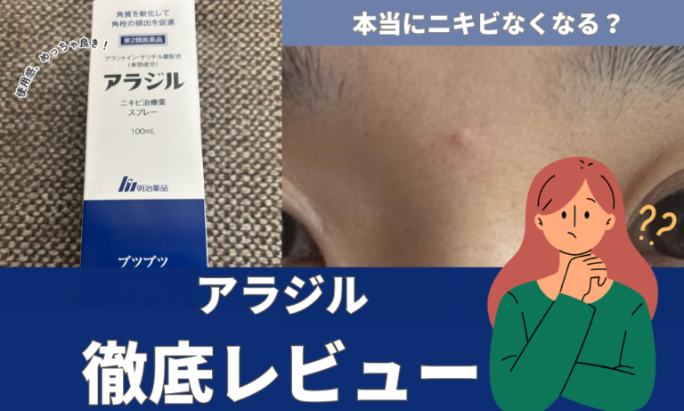 アラジルアイキャッチ