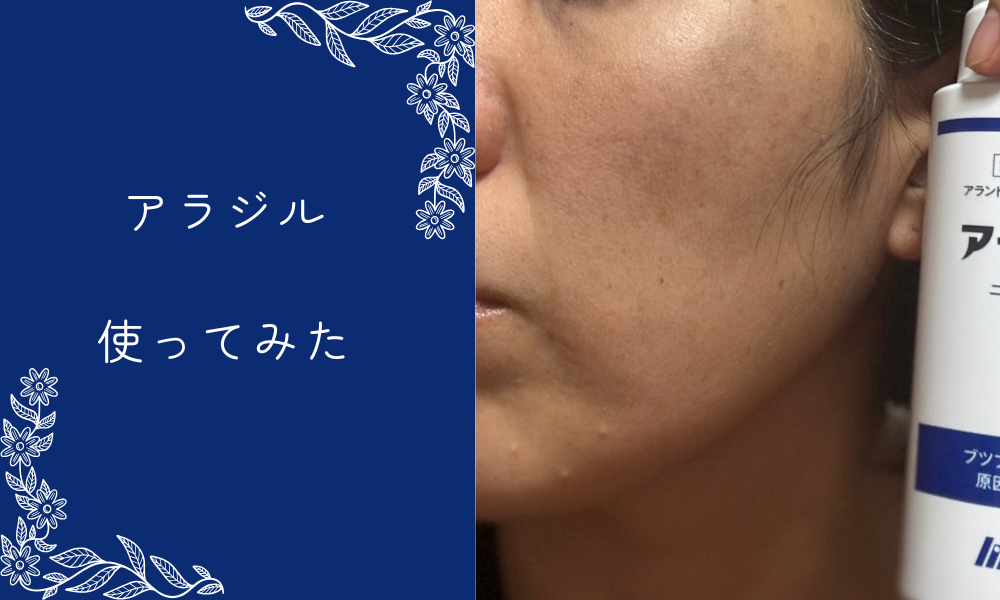 アラジル使ってみた