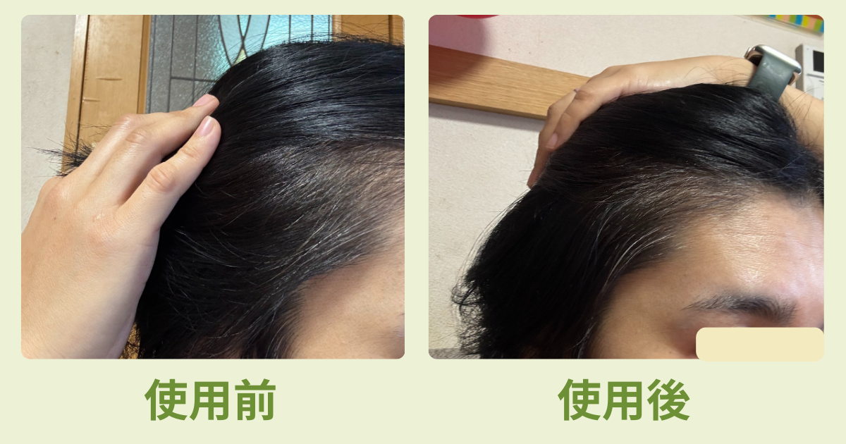 白髪の使用前使用後