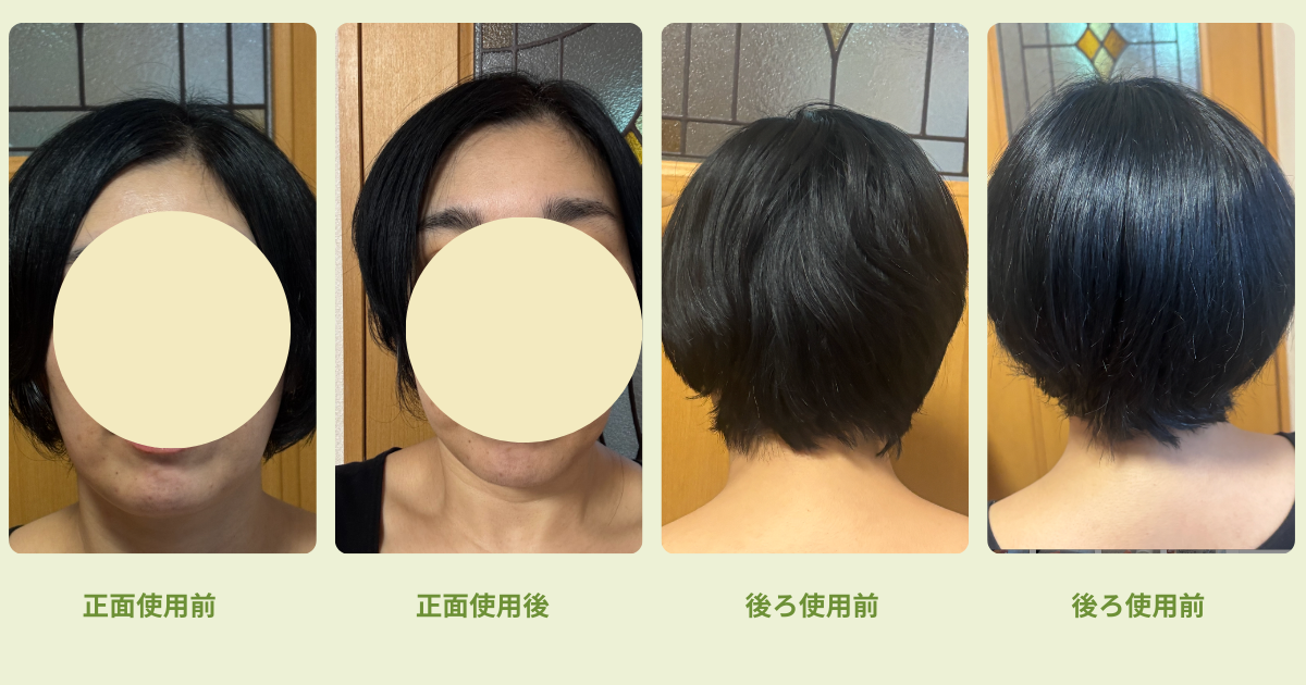 使用前後の写真