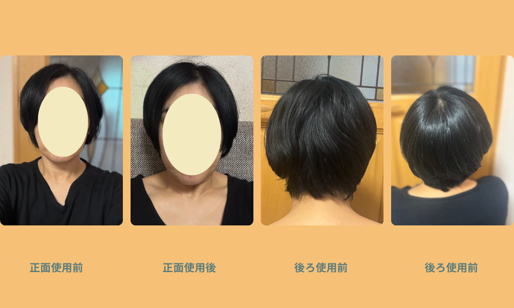 ボンパルム比較