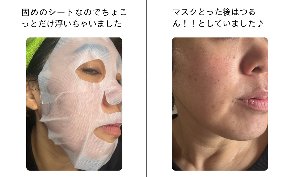 珠肌プレミアムシート使用