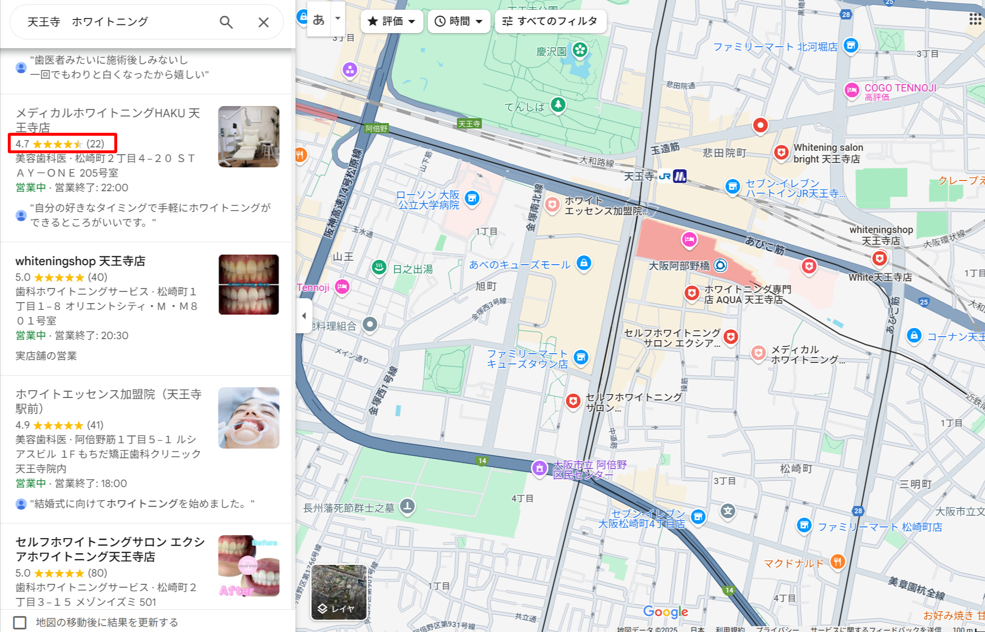 天王寺エリアでホワイトニングができるクリニックのGoogle口コミ